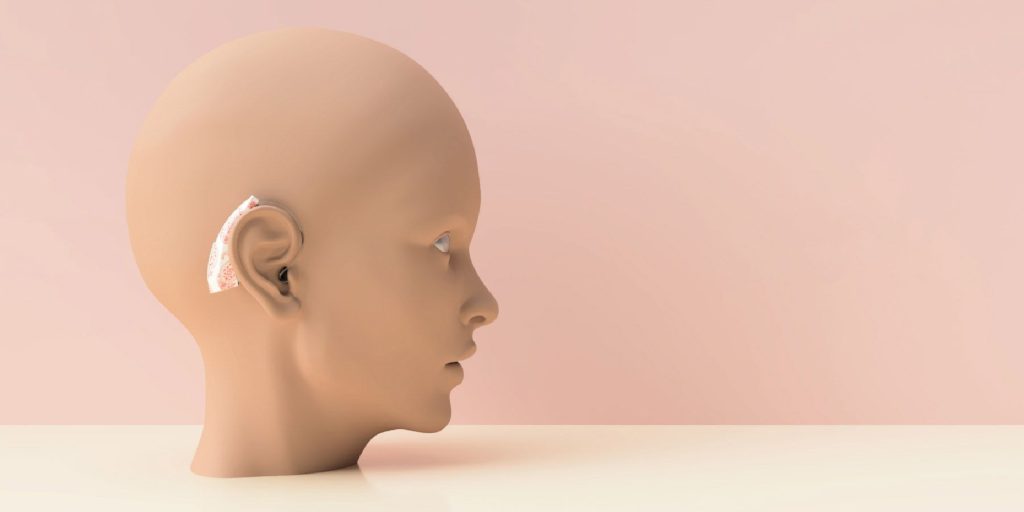 m/قیمت سمعک در تهران