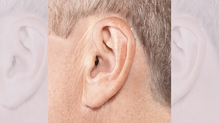 m/خرید و قیمت سمعک در تهران